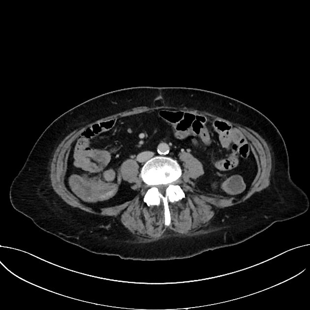 Coronal C+ arterial phase